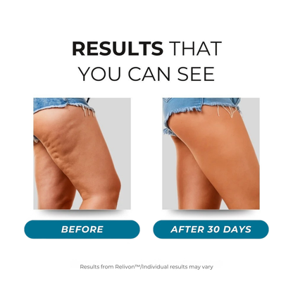 Relivon™ LEGS | Red Light Therapy Panels with 3-Layer relief Technology™